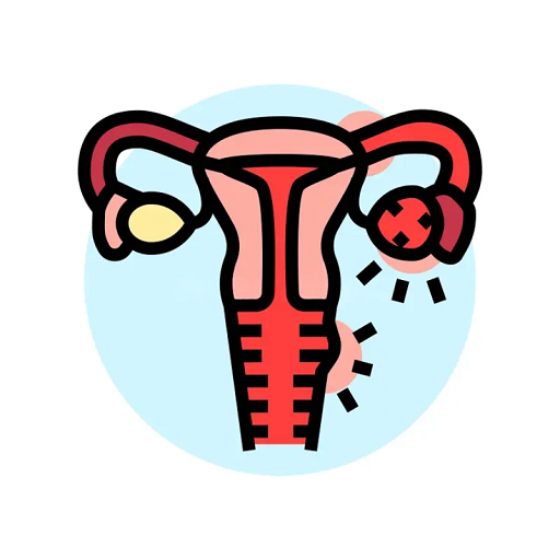 Pelvic Inflammatory Disease (PID)